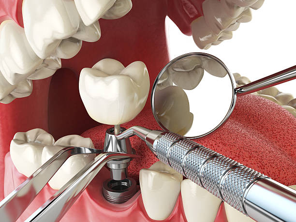 Best Emergency Dentist Near Me  in Silver Springs Shores, FL